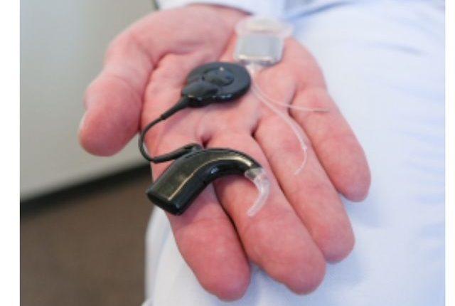„UKSH implantiert weltweit erstmals smartes Cochlea-Implantat“/“Dünya’da İlk Kez Akıllı İşitme İmplantı Uygulandı”